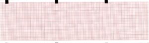 ecg paper 80mm x 90mm x 360sheet (works for hellige contrast, mac 400, mac 600, 2030887-001) (10)