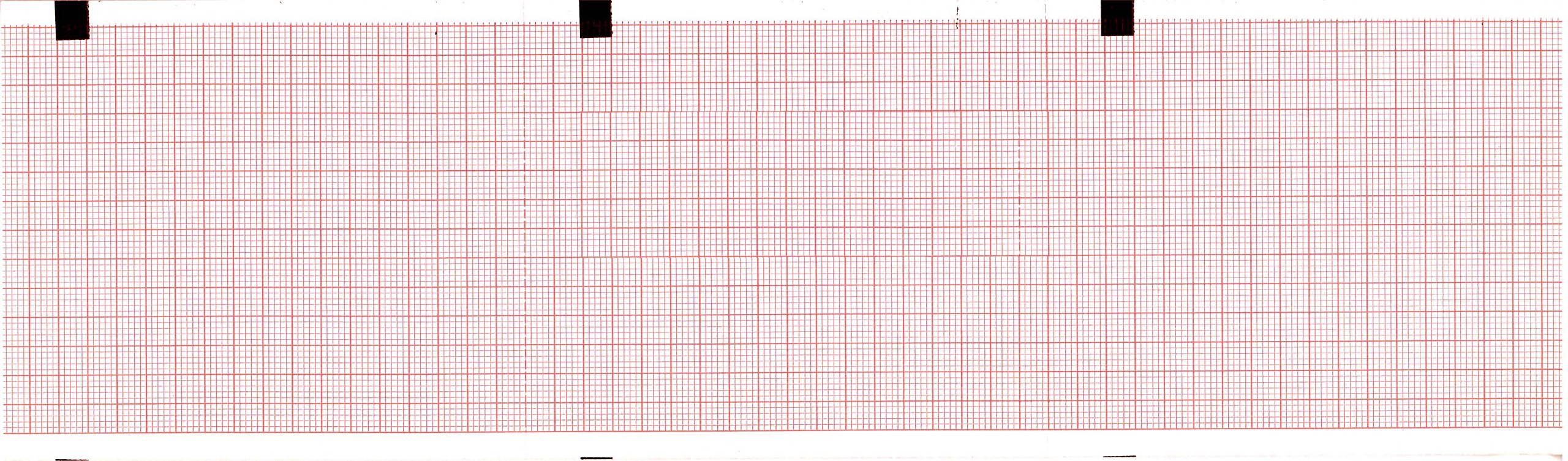 ECG Paper 80MM X 90MM X 360Sheet (Works for HELLIGE Contrast, MAC 400, MAC 600, 2030887-001) (10)